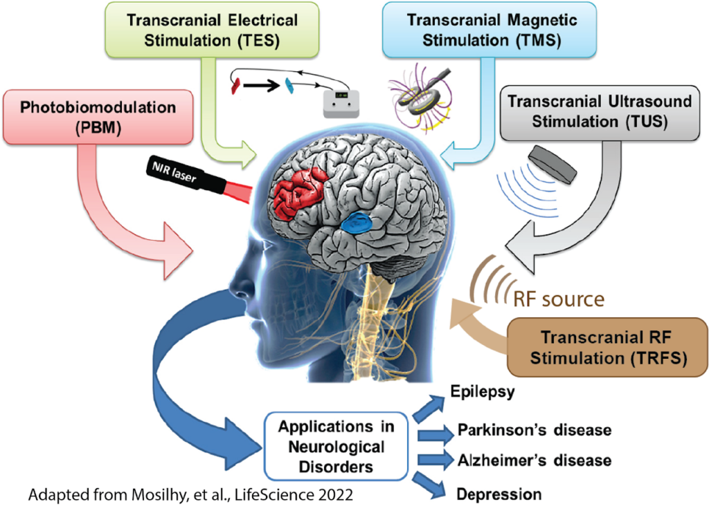 Illustration of various brain stimulation techniques for neurological disorders treatment.